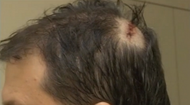 Polícia procura flanelinha que teria agredido juiz com pedaços de madeira