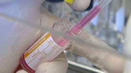 Doenças raras afetam cerca de 15 milhões de brasileiros