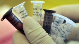 Ministério da Saúde acompanha mutação do vírus H7N9